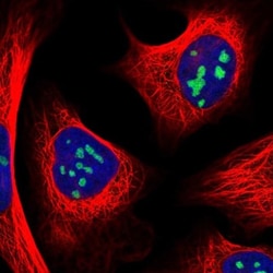 RRS1 Antibody, Novus Biologicals:Antibodies:Primary Antibodies