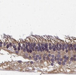 RS1 Antibody, Novus Biologicals 25 &mu;L, Unlabeled:Antibodies, Polyclonal