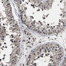 RSBN1L Antibody, Novus Biologicals:Antibodies:Primary Antibodies