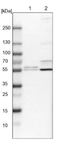 RSBN1L Antibody, Novus Biologicals 0.1mL; Unlabeled:Antibodies, Polyclonal