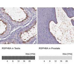 RSHL1 Antibody, Novus Biologicals 25 &mu;L, Unconjugated:Antibodies, Polyclonal