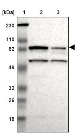 RSK4 Antibody, Novus Biologicals:Antibodies:Primary Antibodies