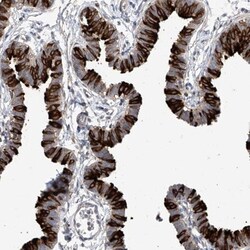 RSPH4A Antibody, Novus Biologicals:Antibodies:Primary Antibodies