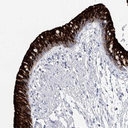 RSPH4A Antibody, Novus Biologicals:Antibodies:Primary Antibodies