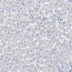 RSPH4A Antibody, Novus Biologicals:Antibodies:Primary Antibodies