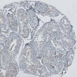 TEDC1 Antibody, Novus Biologicals:Antibodies:Primary Antibodies