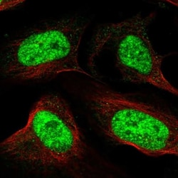 RSRC1 Antibody, Novus Biologicals:Antibodies:Primary Antibodies