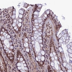 RSRC1 Antibody, Novus Biologicals:Antibodies:Primary Antibodies