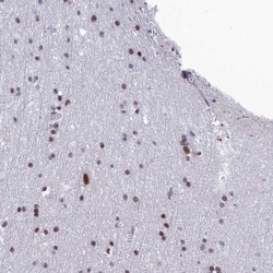 RSRC1 Antibody, Novus Biologicals:Antibodies:Primary Antibodies