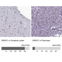 RSRC1 Antibody, Novus Biologicals:Antibodies:Primary Antibodies