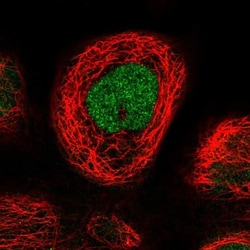 RTCD1 Antibody, Novus Biologicals 0.1mL; Unlabeled:Antibodies, Polyclonal