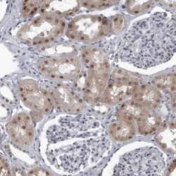 RTCD1 Antibody, Novus Biologicals 0.1mL; Unlabeled:Antibodies, Polyclonal