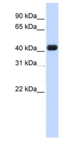 RTCD1 Antibody, Novus Biologicals 100 &mu;L | Buy Online | Novus Biologicals | Fisher Scientific