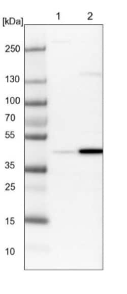 RTCD1 Antibody, Novus Biologicals 0.1mL; Unlabeled:Antibodies, Polyclonal