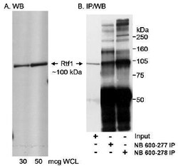 RTF1 Antibody, Novus Biologicals 0.1mg; Unlabeled:Antibodies, Polyclonal