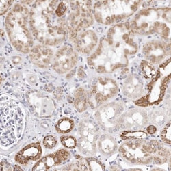 RTKN Antibody, Novus Biologicals 0.1mL; Unlabeled:Antibodies, Polyclonal