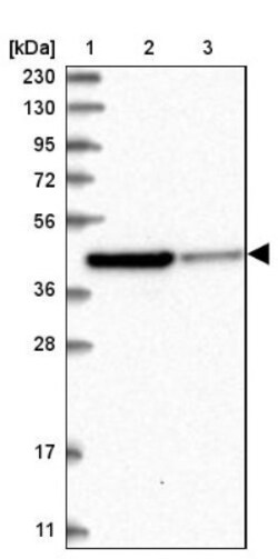 RTKN Antibody, Novus Biologicals 0.1mL; Unlabeled:Antibodies, Polyclonal