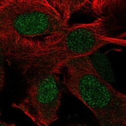 RTP4 Antibody, Novus Biologicals 0.1mL; Unlabeled:Antibodies, Polyclonal