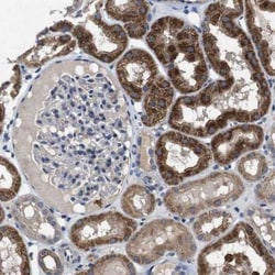 RTVP-1/GLIPR1 Antibody, Novus Biologicals:Antibodies:Primary Antibodies