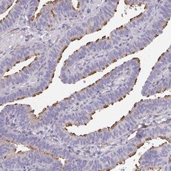 RUNDC3B Antibody, Novus Biologicals:Antibodies:Primary Antibodies