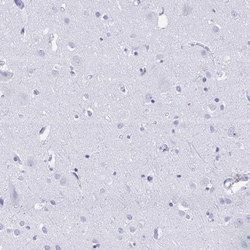 RUNX3/CBFA3 Antibody, Novus Biologicals:Antibodies:Primary Antibodies