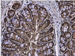 RUVBL1 Antibody, Novus Biologicals 0.1mL; Unlabeled:Antibodies, Polyclonal