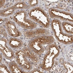 RWDD1 Antibody, Novus Biologicals:Antibodies:Primary Antibodies