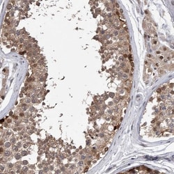 RWDD2A Antibody, Novus Biologicals 0.1mL; Unlabeled:Antibodies, Polyclonal