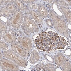 RWDD4A Antibody, Novus Biologicals 0.1mL; Unlabeled:Antibodies, Polyclonal