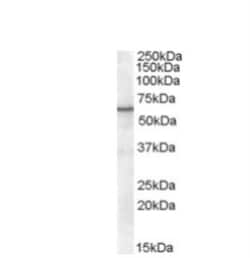 RXR alpha/NR2B1 Antibody, Novus Biologicals 0.1mg; Unlabeled:Antibodies,