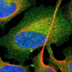 Rab13 Antibody, Novus Biologicals:Antibodies:Primary Antibodies