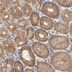 Rab13 Antibody, Novus Biologicals:Antibodies:Primary Antibodies