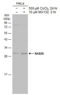 Rab20 Antibody, Novus Biologicals 0.1mL; Unlabeled:Antibodies, Polyclonal