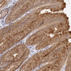 Rab27a Antibody, Novus Biologicals 0.1mL; Unlabeled:Antibodies, Polyclonal