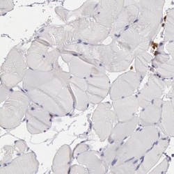 Rab27a Antibody, Novus Biologicals 0.1mL; Unlabeled:Antibodies, Polyclonal