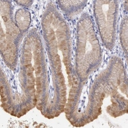Rab27a Antibody, Novus Biologicals 0.1mL; Unlabeled:Antibodies, Polyclonal