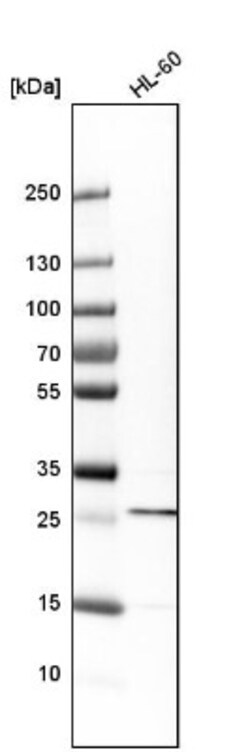 Rab27a Antibody, Novus Biologicals 0.1mL; Unlabeled:Antibodies, Polyclonal