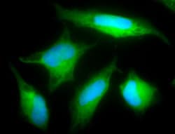 Rab5a Antibody, Novus Biologicals 0.025 mg, Unconjugated:Antibodies, Polyclonal
