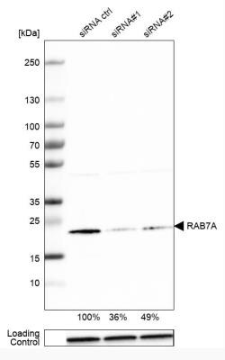 Rab7a Antibody, Novus Biologicals 0.1mL; Unlabeled:Antibodies