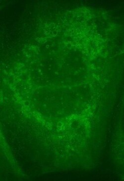 Rabbit anti-Goat IgG (H+L) Secondary Antibody, Novus Biologicals 2mg; Unlabeled:Antibodies,