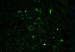 Rac1 Antibody, Novus Biologicals 0.1 mL; Unconjugated:Antibodies, Polyclonal