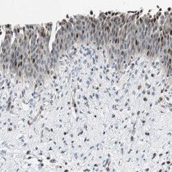 Rad1 Antibody, Novus Biologicals:Antibodies:Primary Antibodies