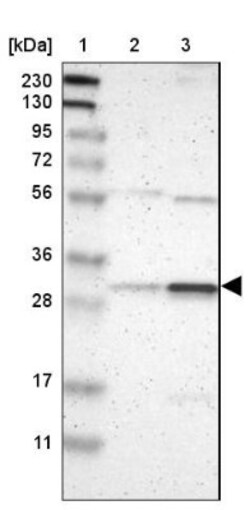 Rad1 Antibody, Novus Biologicals:Antibodies:Primary Antibodies