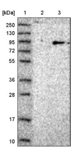 Rad17 Antibody, Novus Biologicals 0.1mL; Unlabeled:Antibodies, Polyclonal