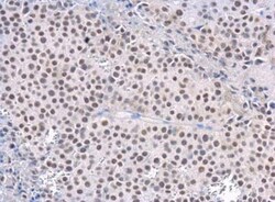 Rad50 Antibody (13B3), Novus Biologicals 0.1mL; Unlabeled:Antibodies, Monoclonal