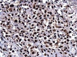 Rad50 Antibody (13B3), Novus Biologicals 0.1mL; Unlabeled:Antibodies, Monoclonal