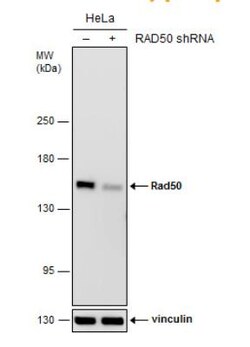 Rad50 Antibody (13B3), Novus Biologicals 0.1mL; Unlabeled:Antibodies, Monoclonal