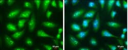 Rad51 Antibody, Novus Biologicals 0.1mL; Unlabeled:Antibodies, Polyclonal