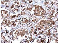 Rad51 Antibody, Novus Biologicals 0.1mL; Unlabeled:Antibodies, Polyclonal