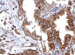 Rad51 Antibody, Novus Biologicals 0.1mL; Unlabeled:Antibodies, Polyclonal